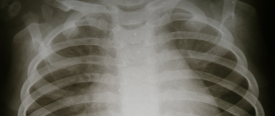 Diagnostic X-rays | Women's Imaging Center